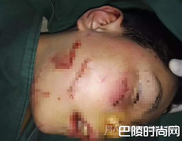 面部受伤 面部受伤