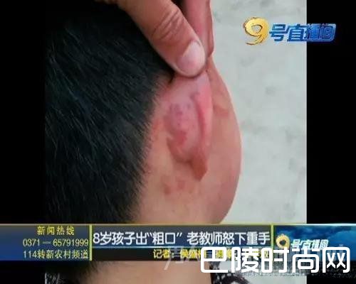 孩子遭老师掌掴