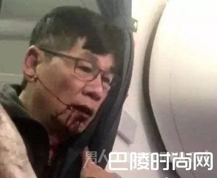 被赶医生满嘴是血 被赶医生满嘴是血