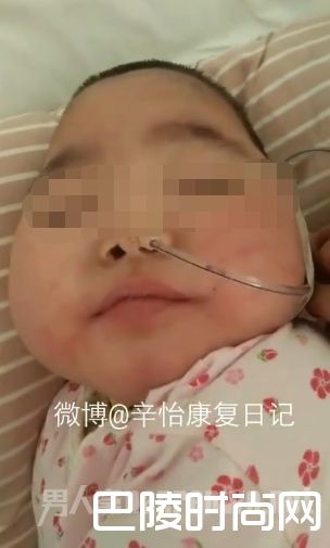 女童被虐打昏迷545天 女童被虐打昏迷545天