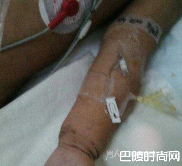 女童被虐打昏迷545天