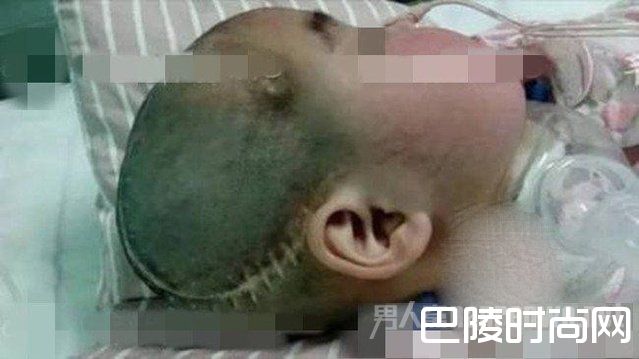 女童被虐打昏迷545天