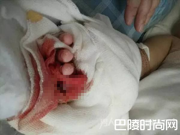 被包裹的手 被包裹的手