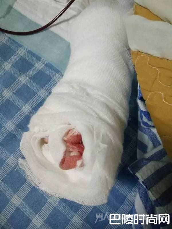 被包裹的手 被包裹的手