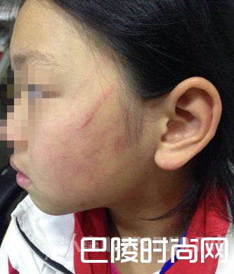 女孩被老师扇巴掌 女孩被老师扇巴掌