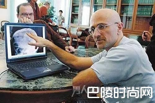 意大利神经外科医生卡纳维罗(右) 意大利神经外科医生卡纳维罗(右)