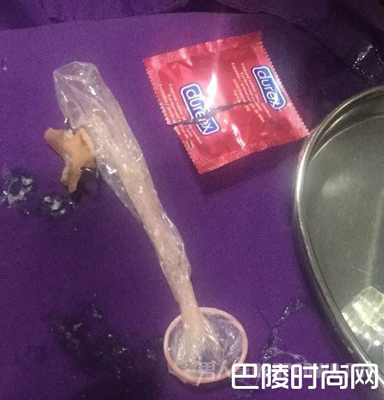 避孕套取出假牙