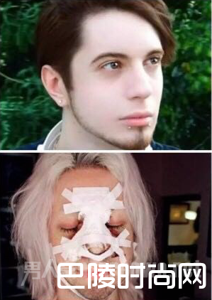 男子整容成精灵 男子整容成精灵