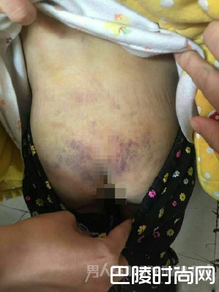 虐童事件 虐童事件