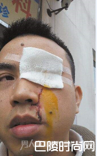 男子眼睛受伤