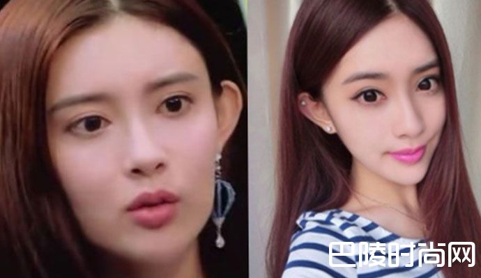 孟子义网红脸又整容吗