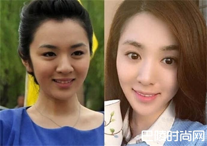 网传王晓晨整容前后对比照