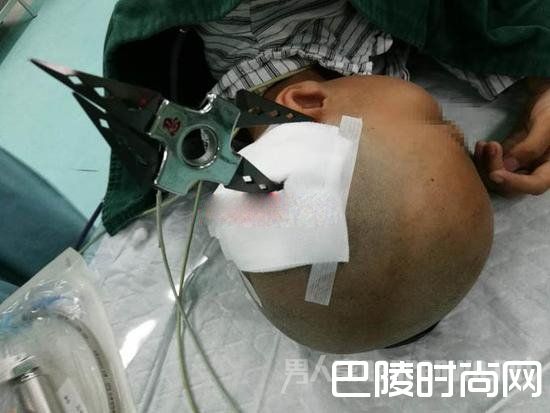 飞镖插入女孩头颅 飞镖插入女孩头颅