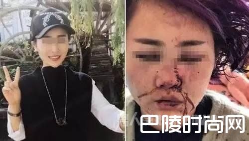 丽江女游客被打 丽江女游客被打