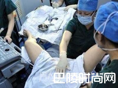 手术取卵 手术取卵