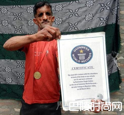 男子患病成橡皮人 男子患病成橡皮人