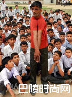 男子患病成橡皮人 男子患病成橡皮人