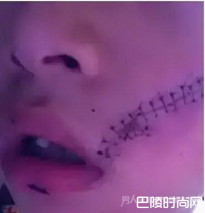 冰箱拿饮料爆炸