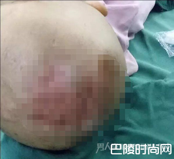 头上布满了被烫伤或烧伤的痕迹