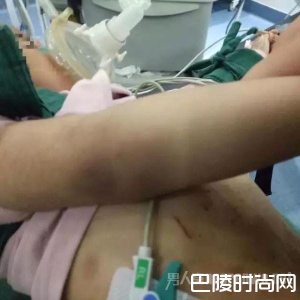 3岁女童浑身是伤