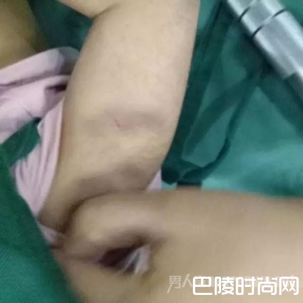 全身的伤痕淤青