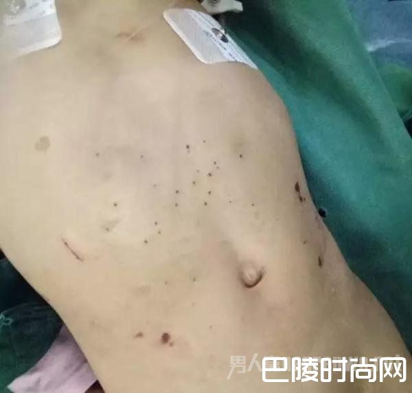 身上布满了伤痕