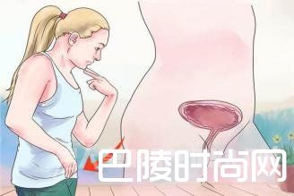 阴道松弛 阴道松弛