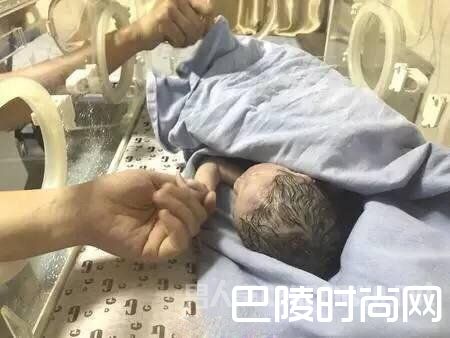 女婴接受治疗