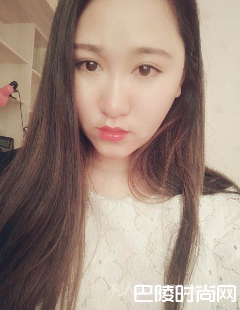 术后20天 术后20天