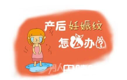妊娠纹 妊娠纹
