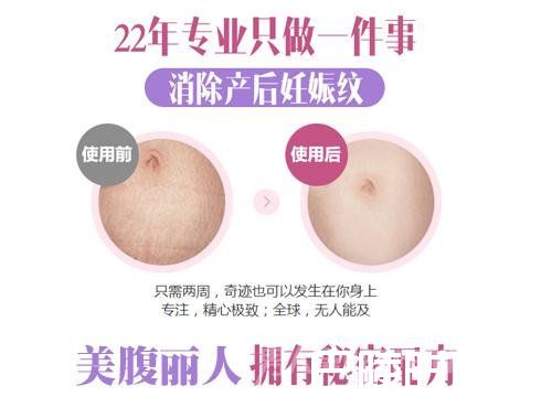 去妊娠纹 去妊娠纹
