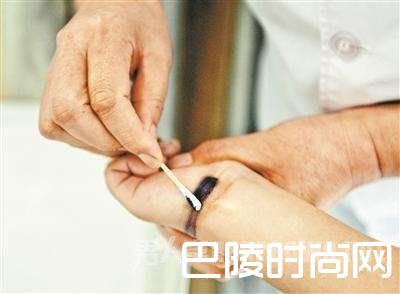 白癜风男孩用墨水涂黑白斑