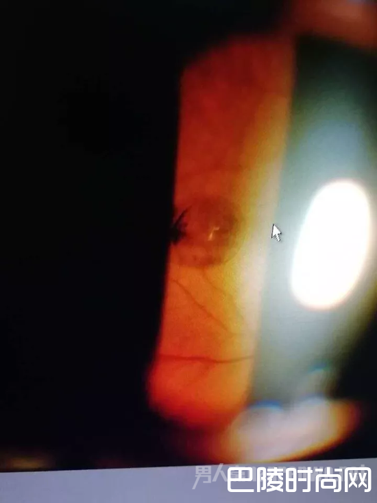 半透明“珍珠”