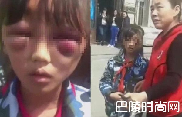 女童被继母虐打