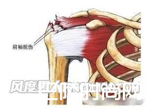 肩袖肌腱 肩袖肌腱