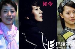 演员海清疑似整容照被曝光 海清：我没整容