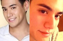 杜天皓整容前后对比照被曝 个性直率的“招黑体” 