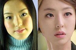 李多喜整容前图片对比 大爆料其个人详细资料 