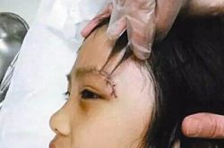 导演吴镇宇儿子现在怎么样 拍摄节目费曼受伤引热议 