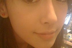 Angelababy个人资料,Angelababy整容风波