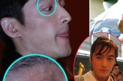 胡歌眼角疤痕仍在 受伤九年后成功蜕变 