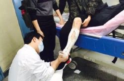 白百何曝光受伤现场照片 疑似录制王牌对王牌导致受伤骨裂 