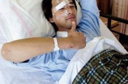 胡歌车祸面部修复图曝光 分享每天脸要压皮的痛苦经历 