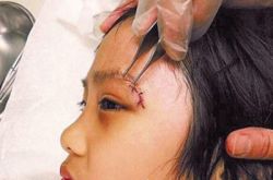 爸爸去哪儿吴镇宇图片鉴赏 还原受伤事情真相 