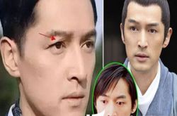 揭秘胡歌出车祸是怎么回事 一个古装美男差点毁容 