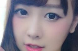 snh48黄安琪道出烧伤事件真相 引网友质疑凶手后台硬 