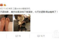 小S又被“家暴”? 晒腿伤竟遭网友调侃