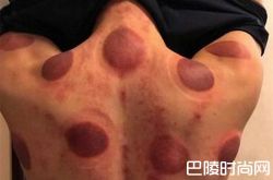 张云龙拍戏健康受损，粉丝们大呼心疼叮嘱其注意身体