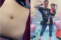 黄小柔一年生2胎 光滑无痕超紧腹肌是顺产吗