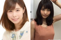 有村架纯姐姐有村蓝里切掉牙龈拔6齿 变美成写真女星